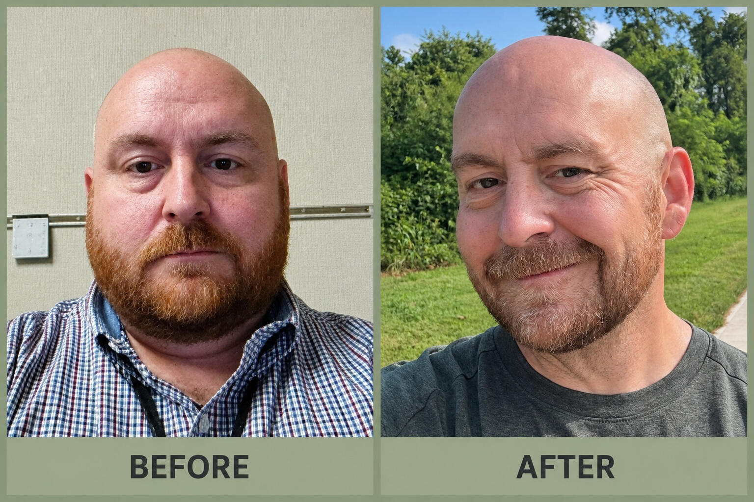 Before and After Me in 2025 and me now.